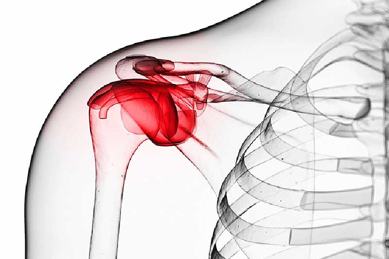 болезнь паркинсона. синдром застывшего человека. причины синдрома замороженного плеча. признаки болезни паркинсона. синдром застывшего человека.