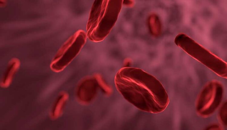 Kanda enfeksiyon nedir Kanda enfeksiyon çıkması Sepsis nedir