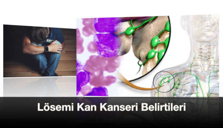 Kan kanseri belirtileri lösemi | Lösemide wbc değeri | Lösemide kan tablosu