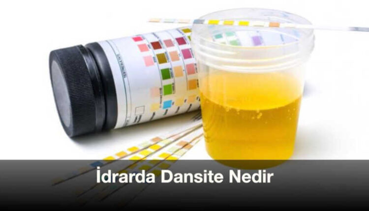 Dansite nedir ne demek tıp | Bebeklerde dansite düşüklüğü | Dansite 1015