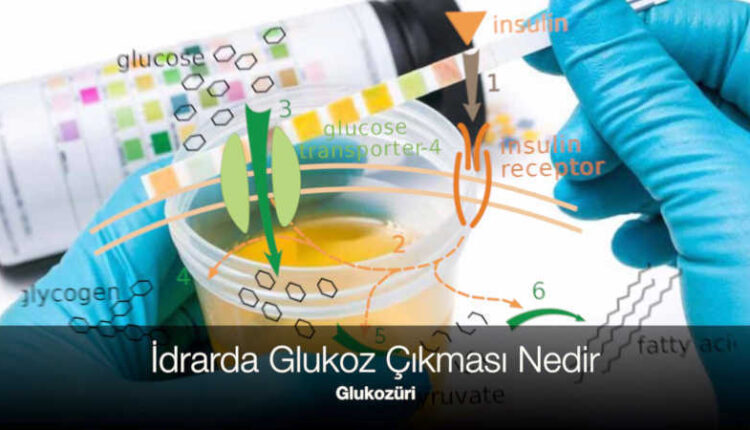 Glukozüri nedir | idrarda glukoz +++ | idrarda glukoz eser ne demek | GLU