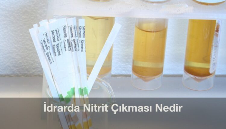 NIT idrarda nitrit nedir | idrarda nitrit tedavisi | idrarda nitrat pozitif |